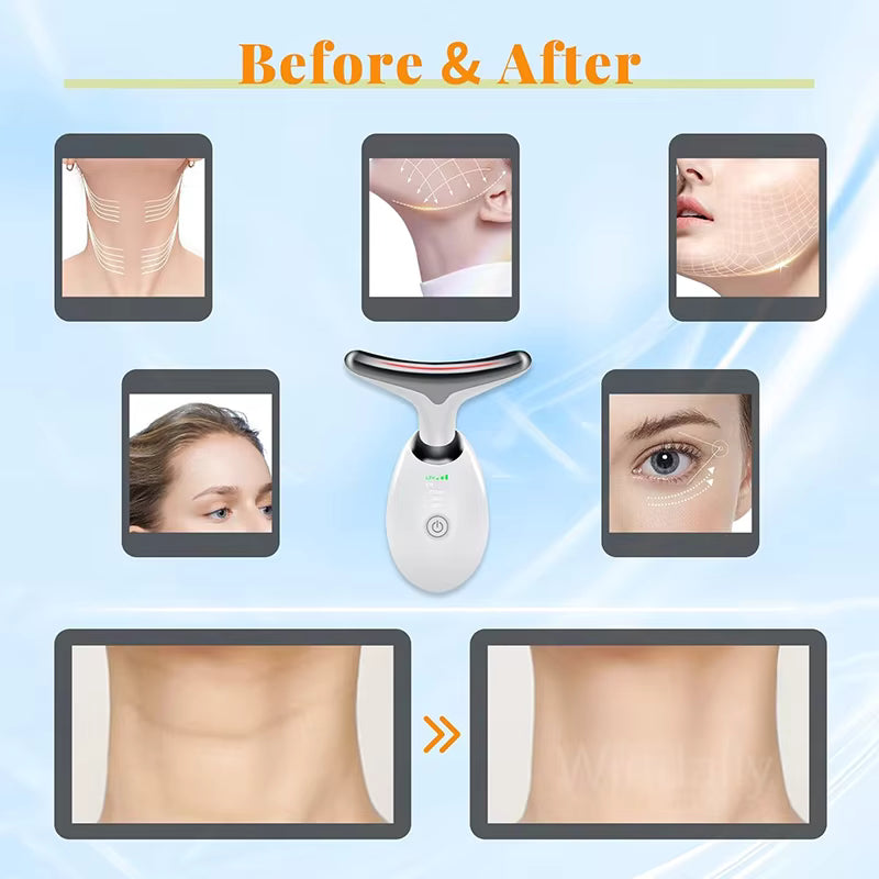 Face Lift 7 Colors – Anti-Aging & Skin Tightening Device